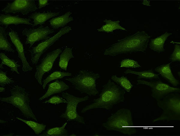 TPRKB Antibody in Immunocytochemistry (ICC/IF)