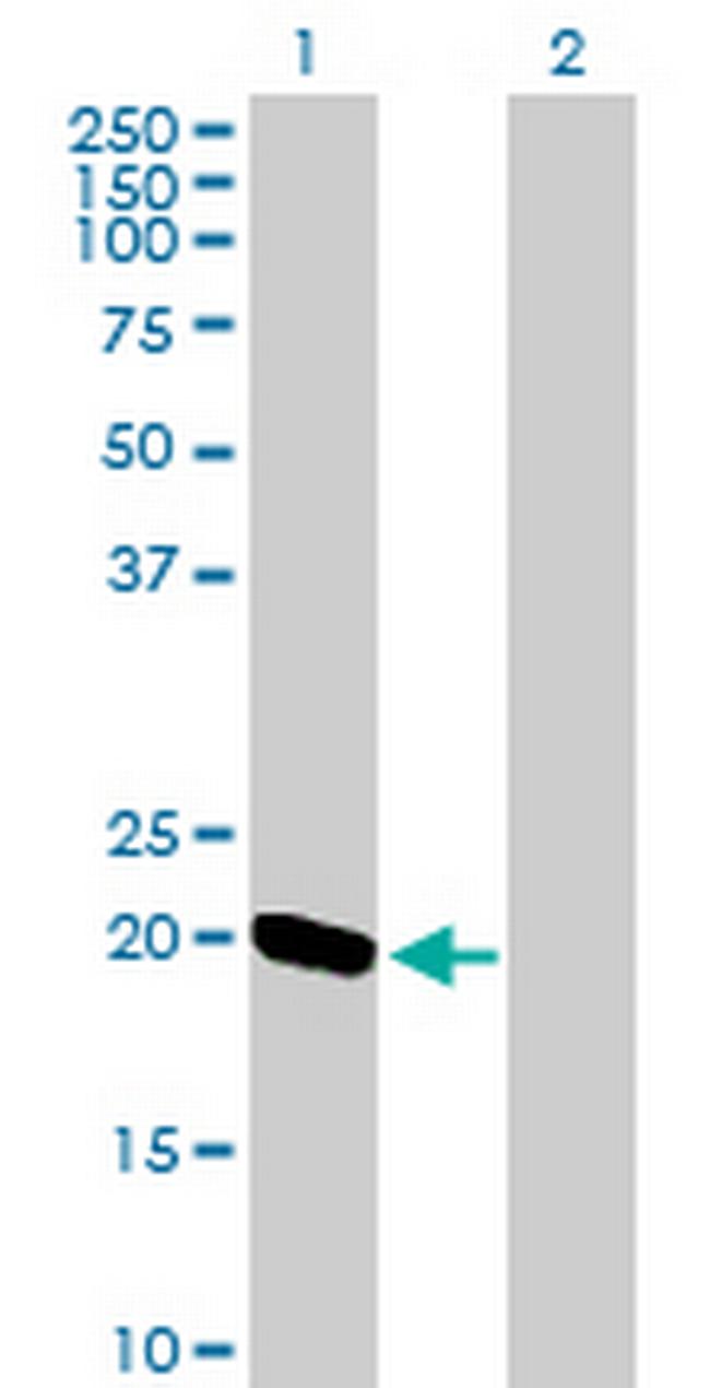 EXOSC1 Antibody in Western Blot (WB)