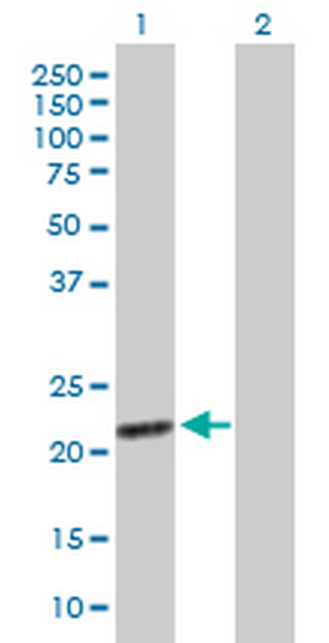 EXOSC1 Antibody in Western Blot (WB)