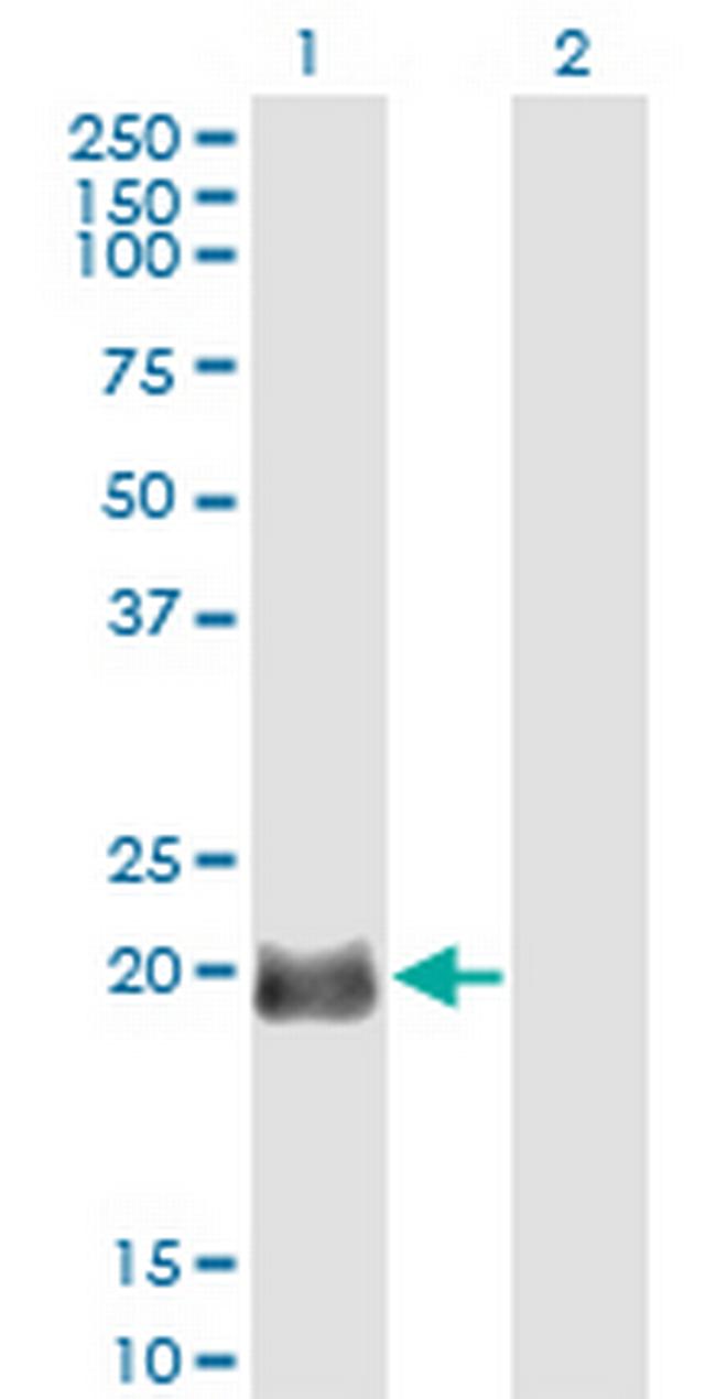 EXOSC1 Antibody in Western Blot (WB)