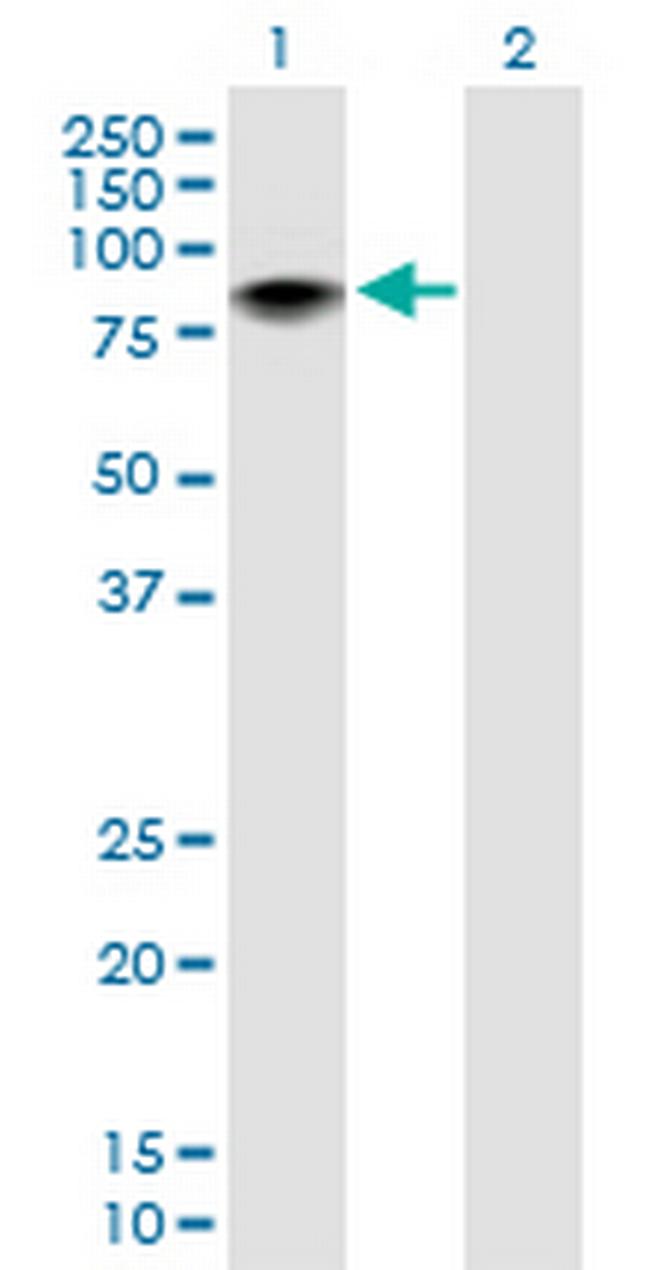 ZBTB7B Antibody in Western Blot (WB)