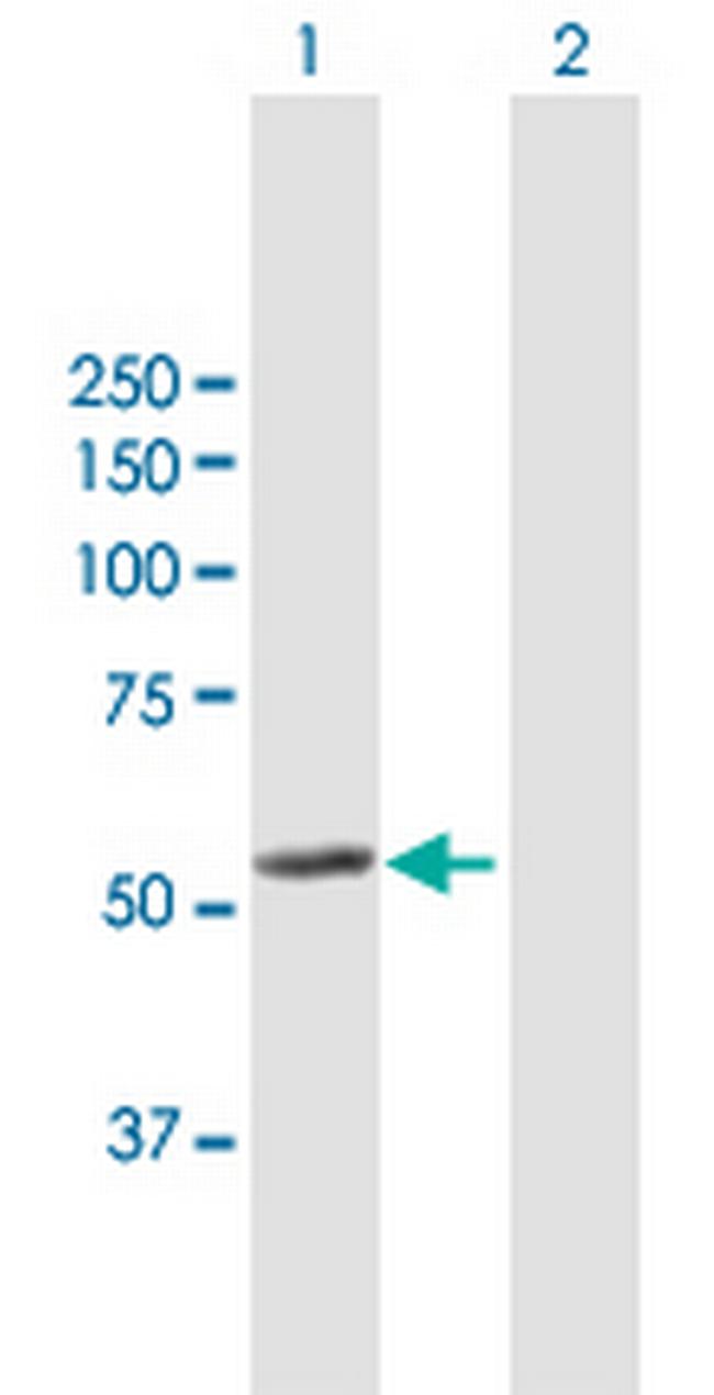 LAP3 Antibody in Western Blot (WB)