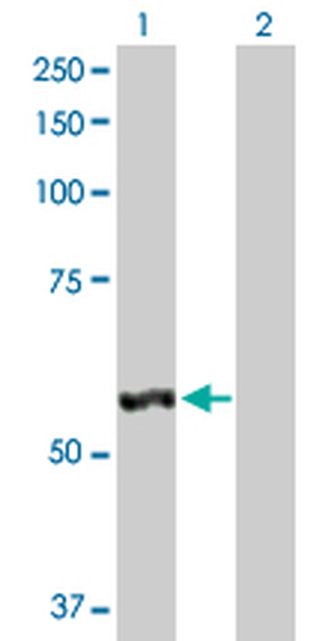 LAP3 Antibody in Western Blot (WB)