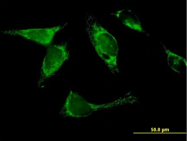 YARS2 Antibody in Immunocytochemistry (ICC/IF)