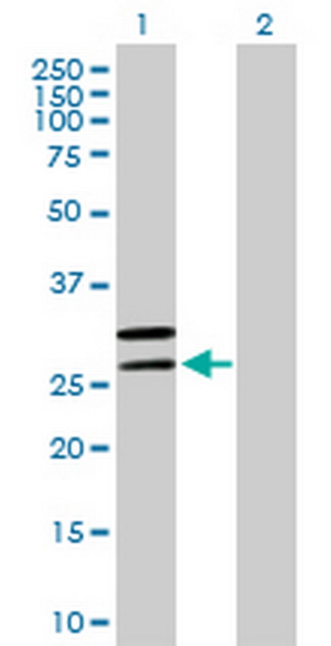 MRPL2 Antibody in Western Blot (WB)