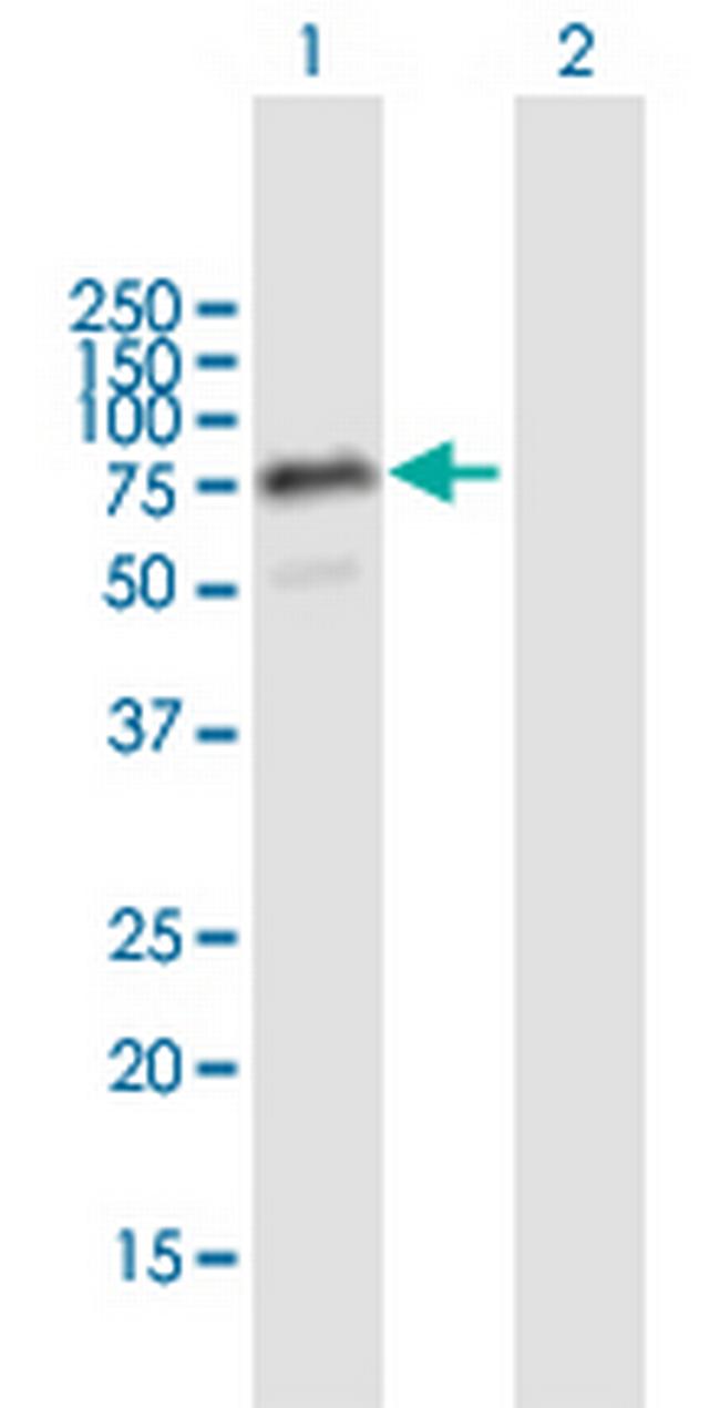 THAP4 Antibody in Western Blot (WB)