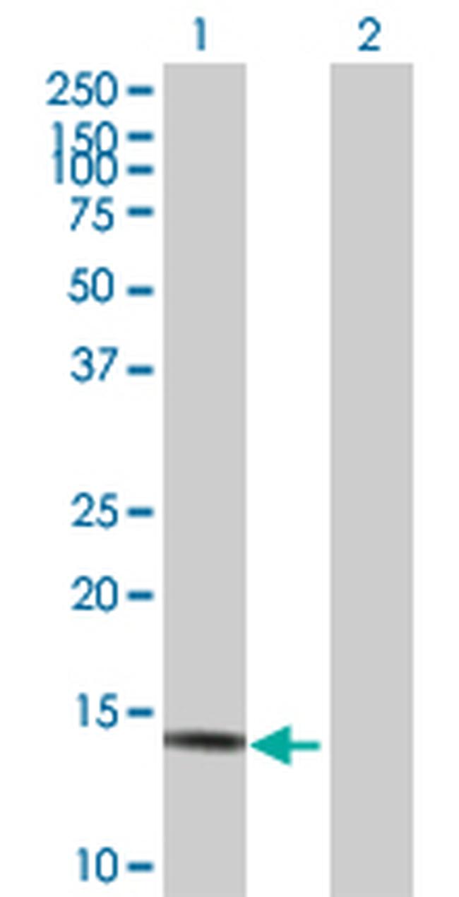 NDUFA13 Antibody in Western Blot (WB)