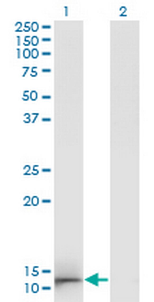 GAL Antibody in Western Blot (WB)