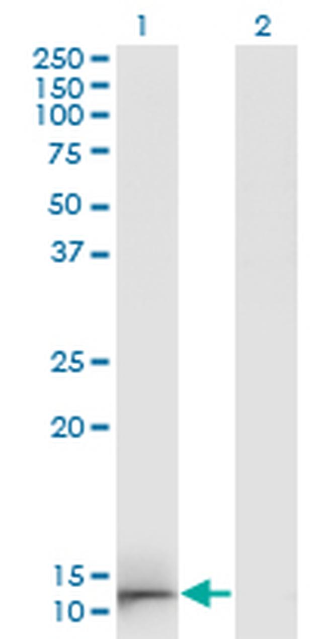 GAL Antibody in Western Blot (WB)