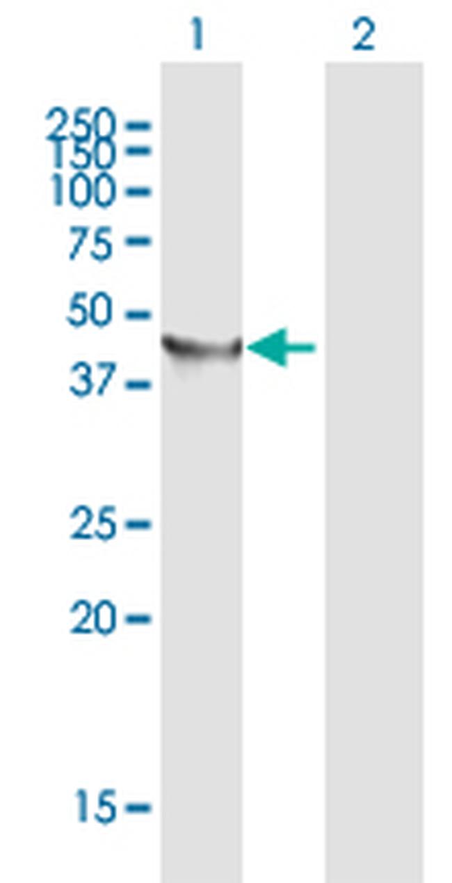 TRNT1 Antibody in Western Blot (WB)