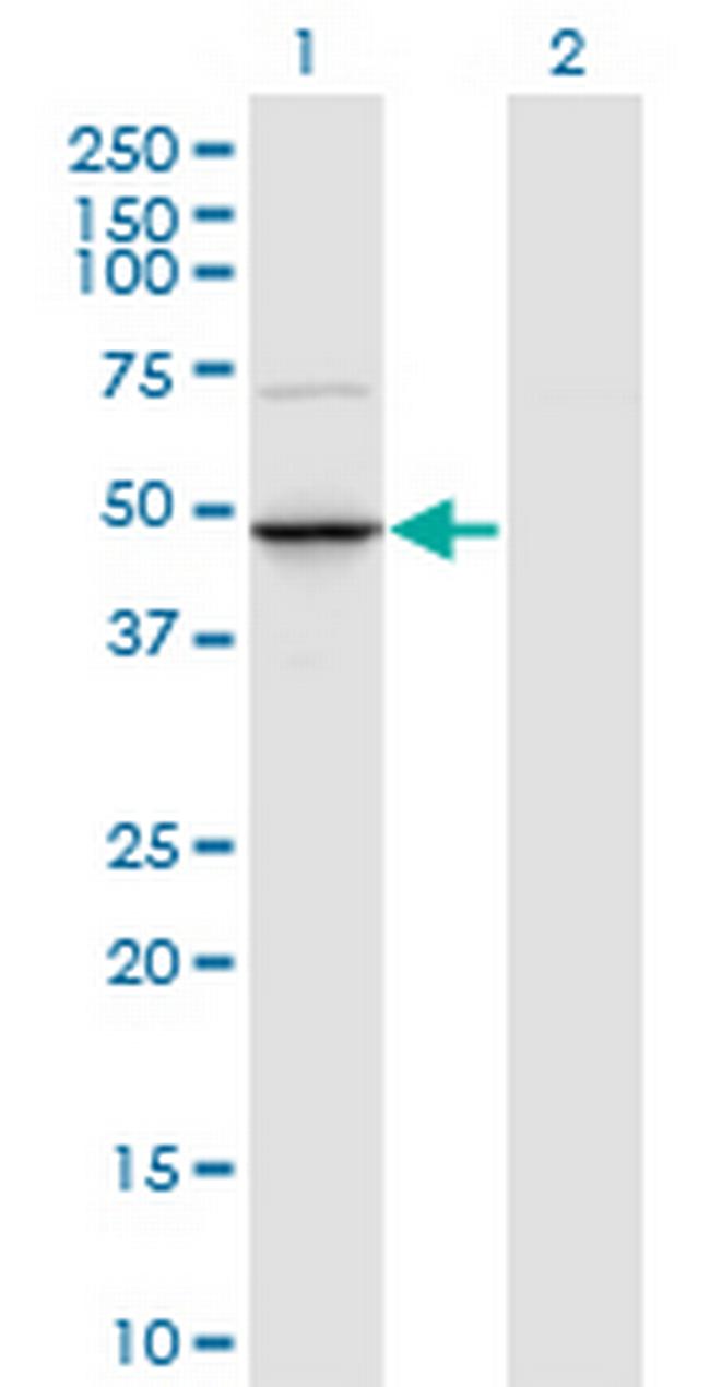 TRNT1 Antibody in Western Blot (WB)
