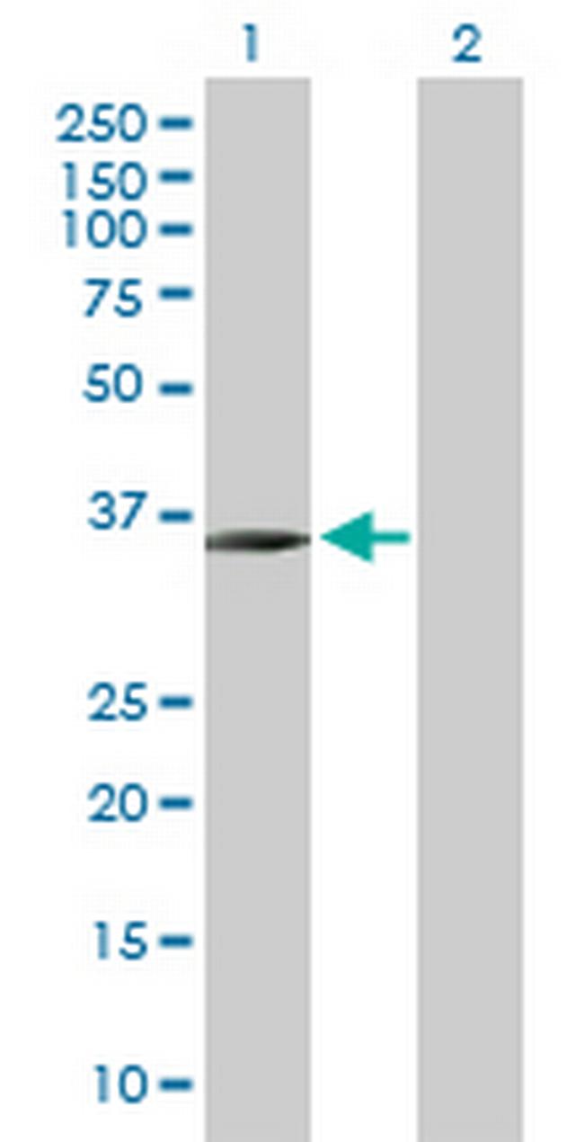 C8orf70 Antibody in Western Blot (WB)