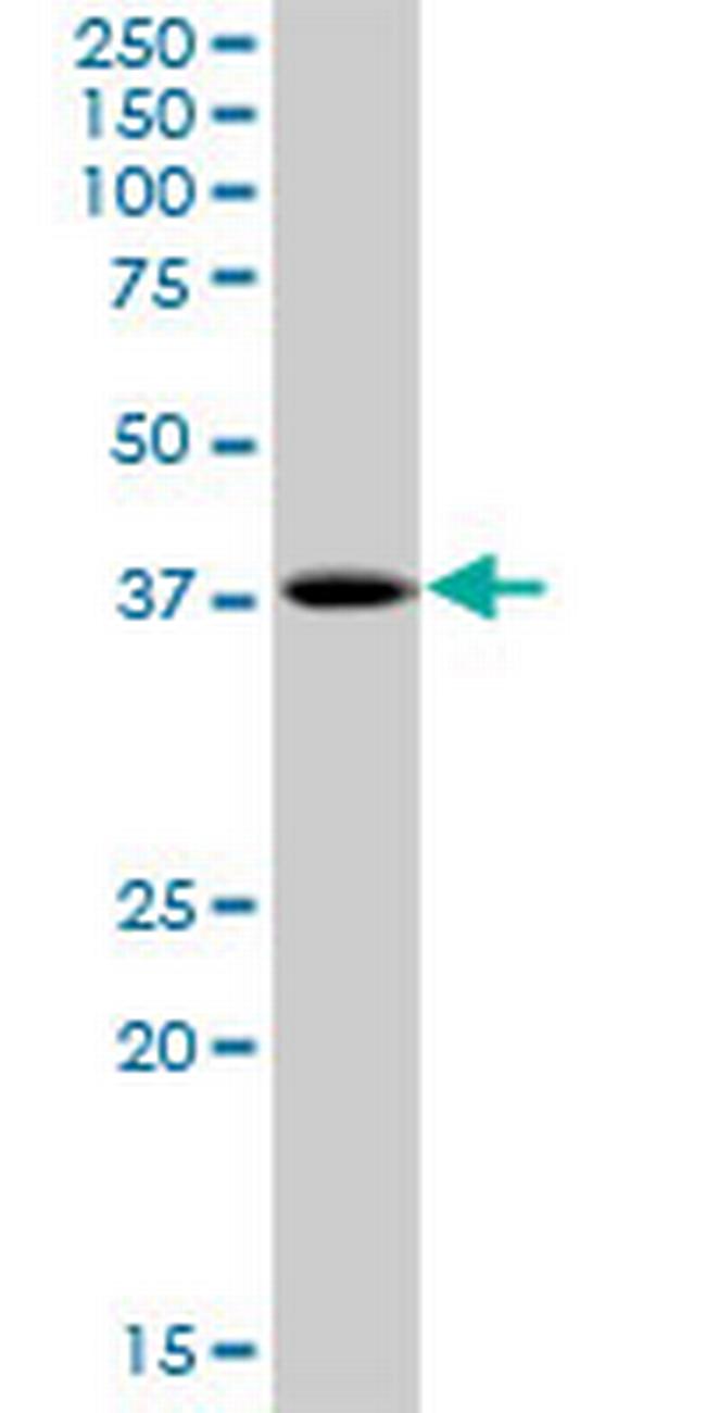 PHF20L1 Antibody in Western Blot (WB)