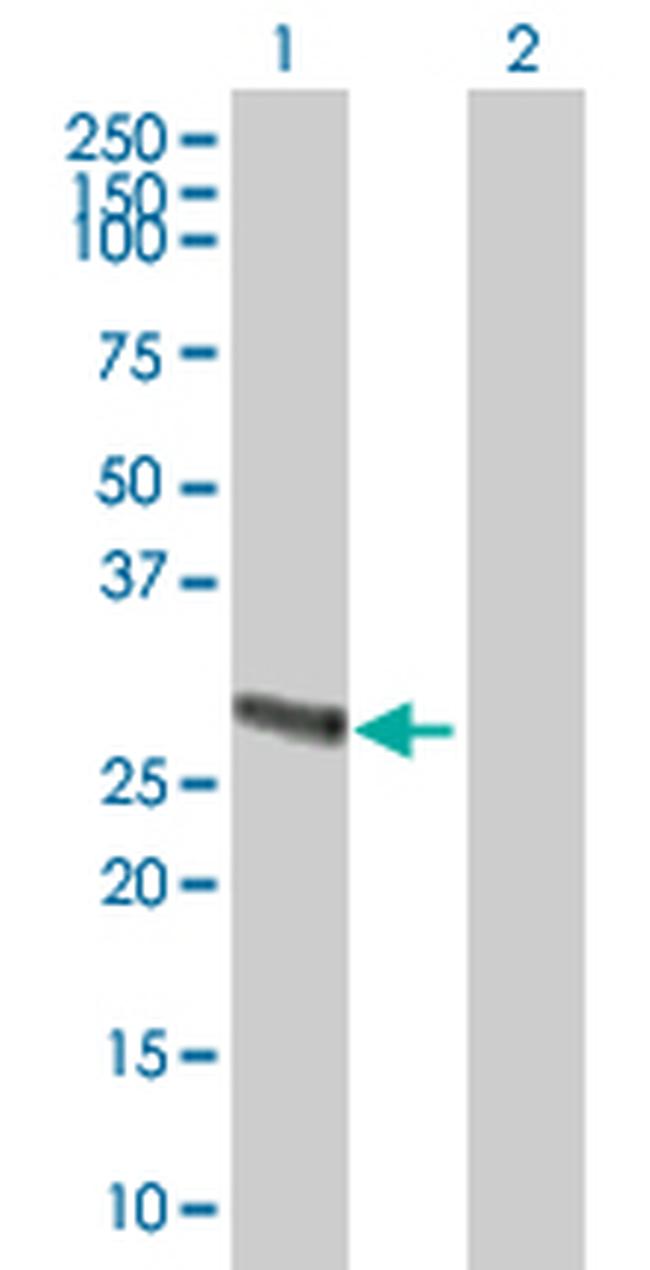 METTL9 Antibody in Western Blot (WB)