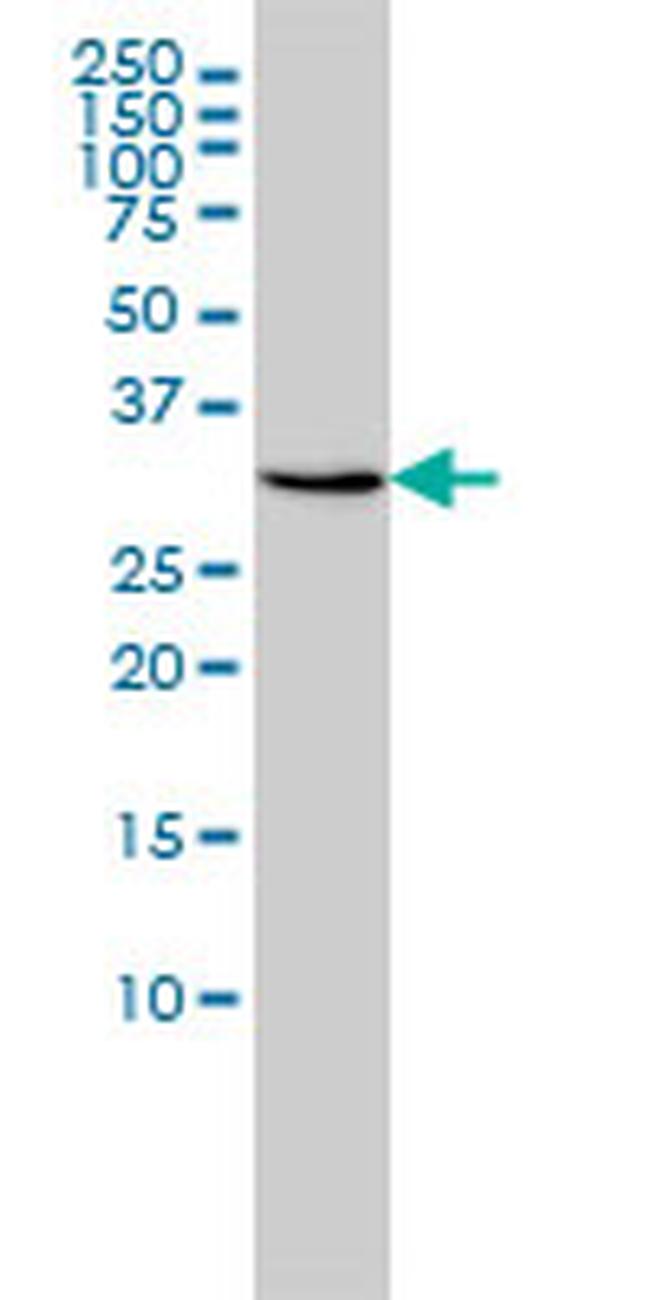 RDH11 Antibody in Western Blot (WB)