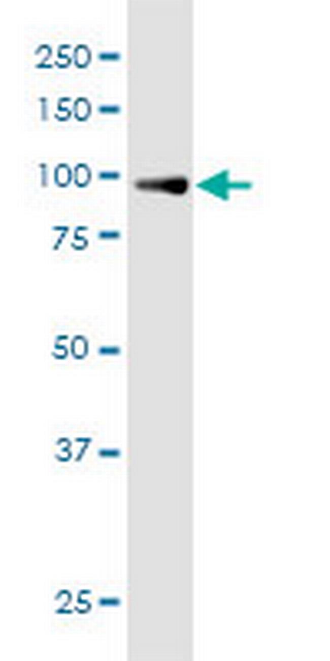 TTC15 Antibody in Western Blot (WB)