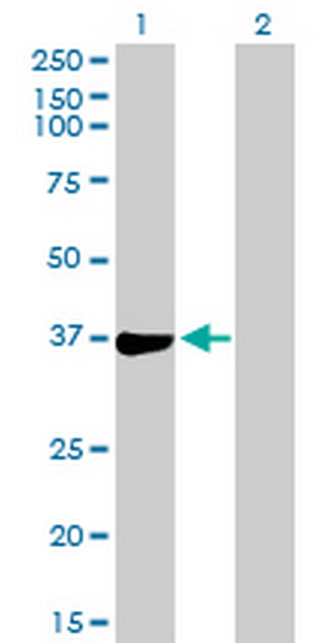 PHF11 Antibody in Western Blot (WB)