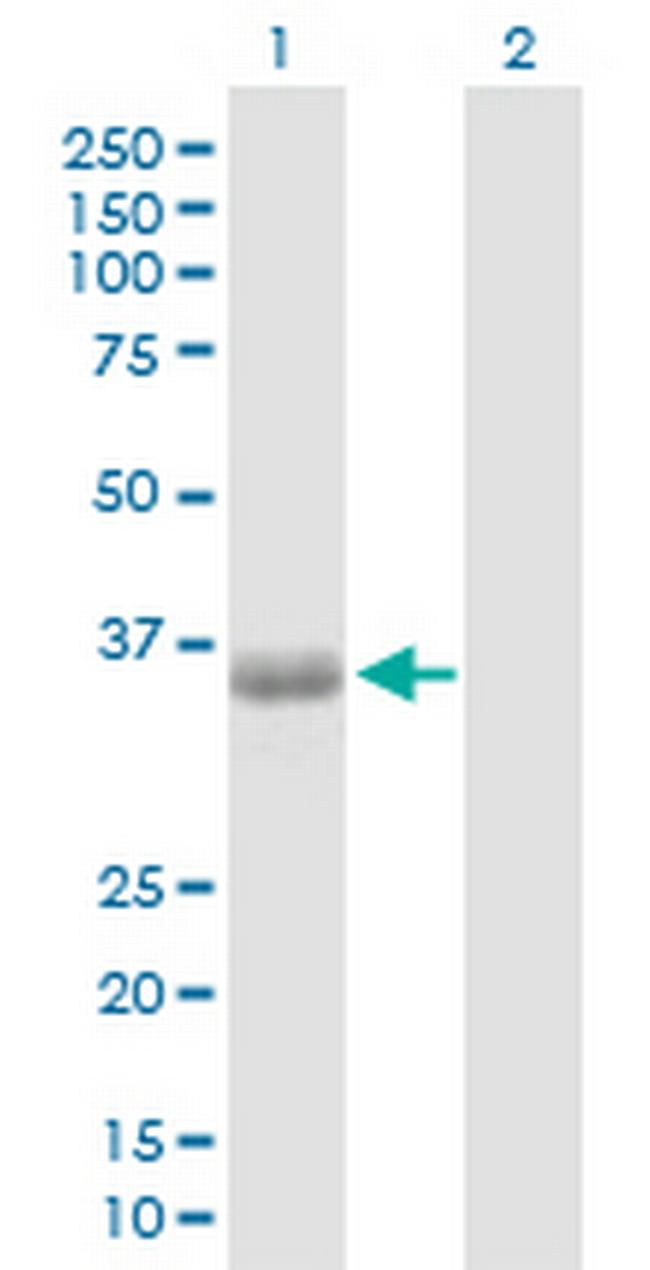 PHF11 Antibody in Western Blot (WB)