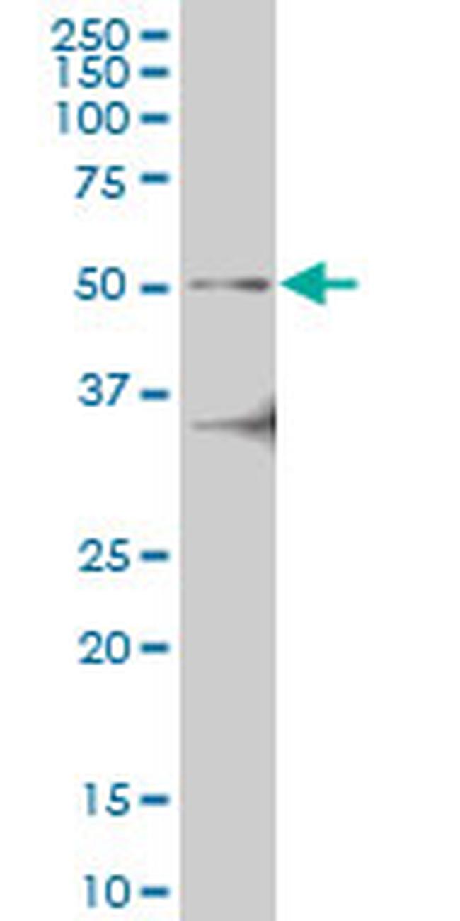 IRAK4 Antibody in Western Blot (WB)
