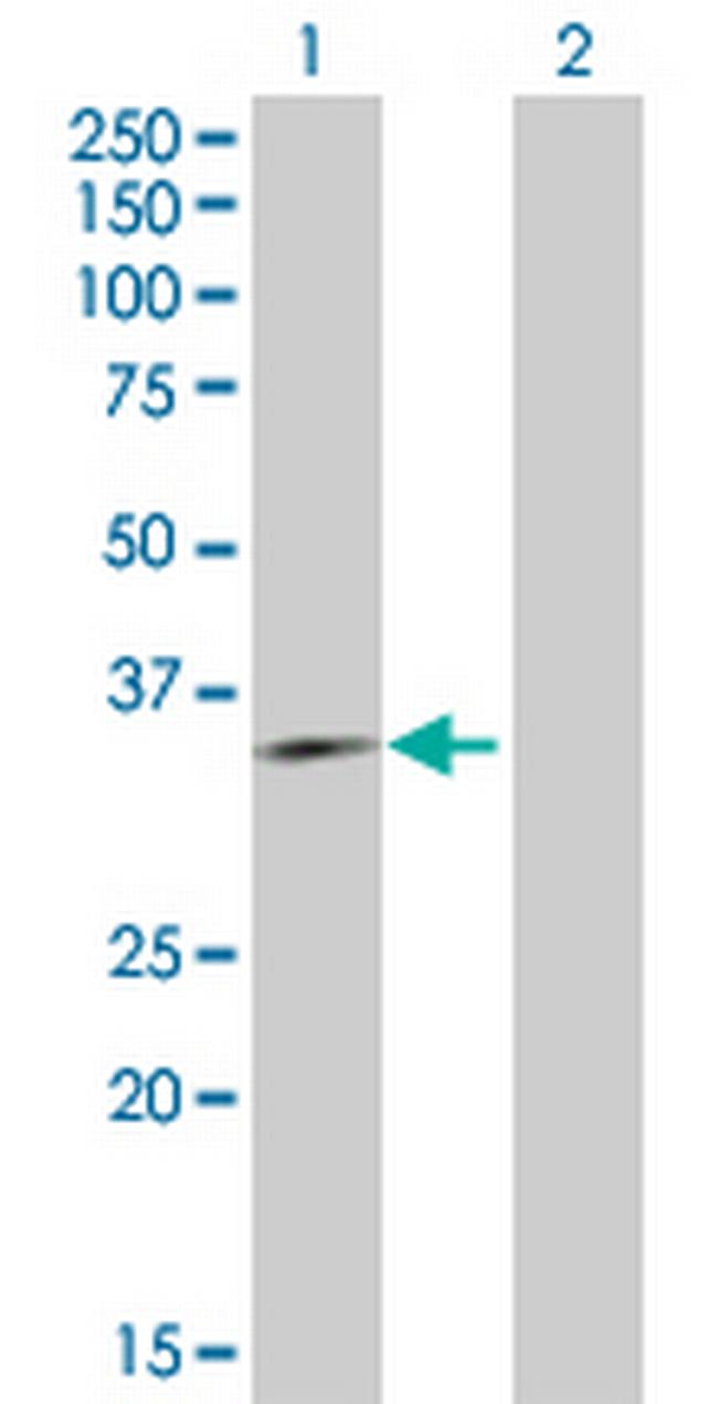 ING4 Antibody in Western Blot (WB)