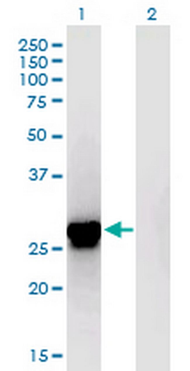 ING4 Antibody in Western Blot (WB)