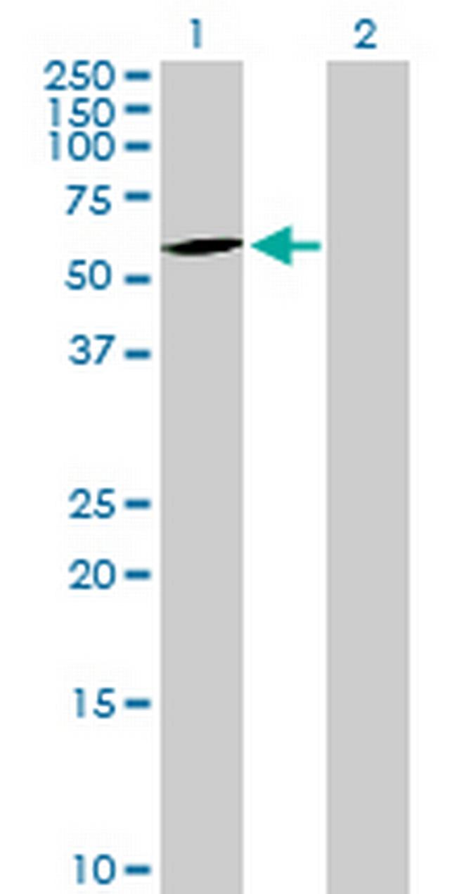 CERCAM Antibody in Western Blot (WB)