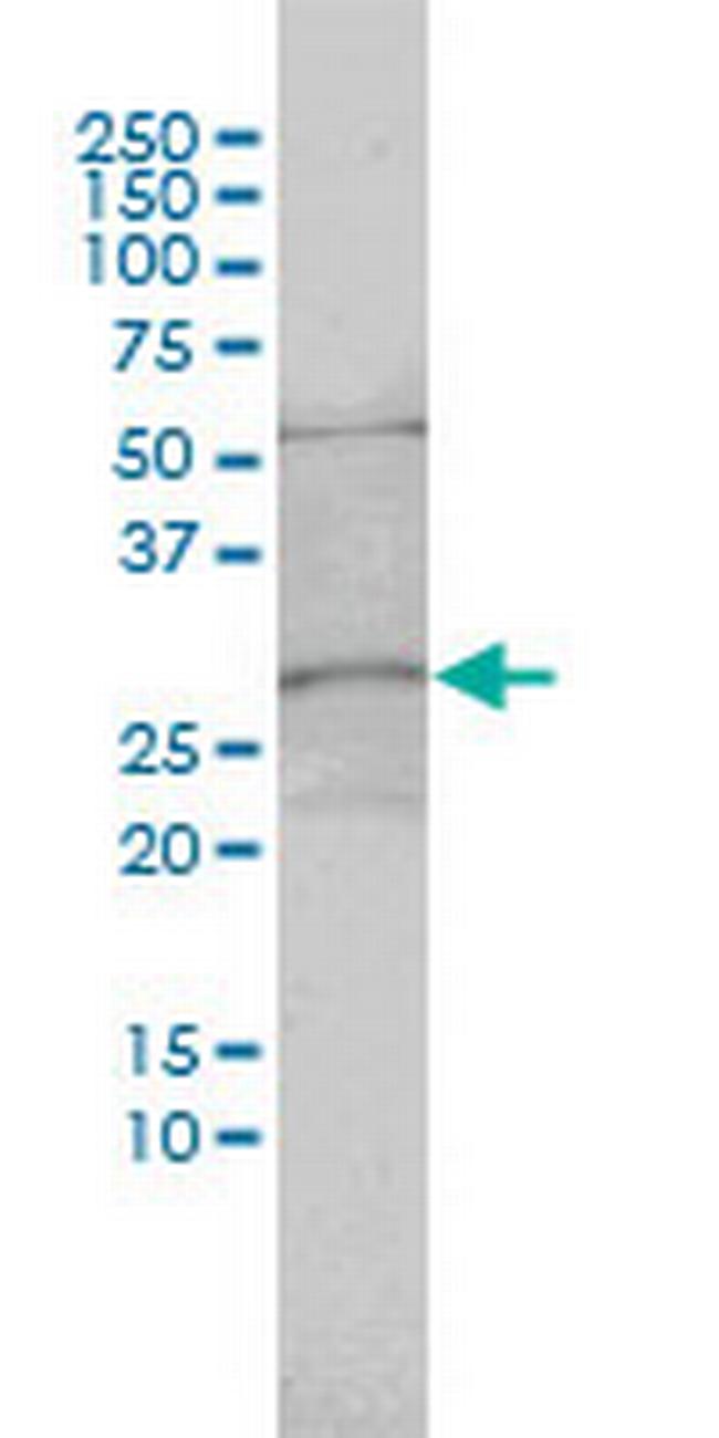 C1orf33 Antibody in Western Blot (WB)