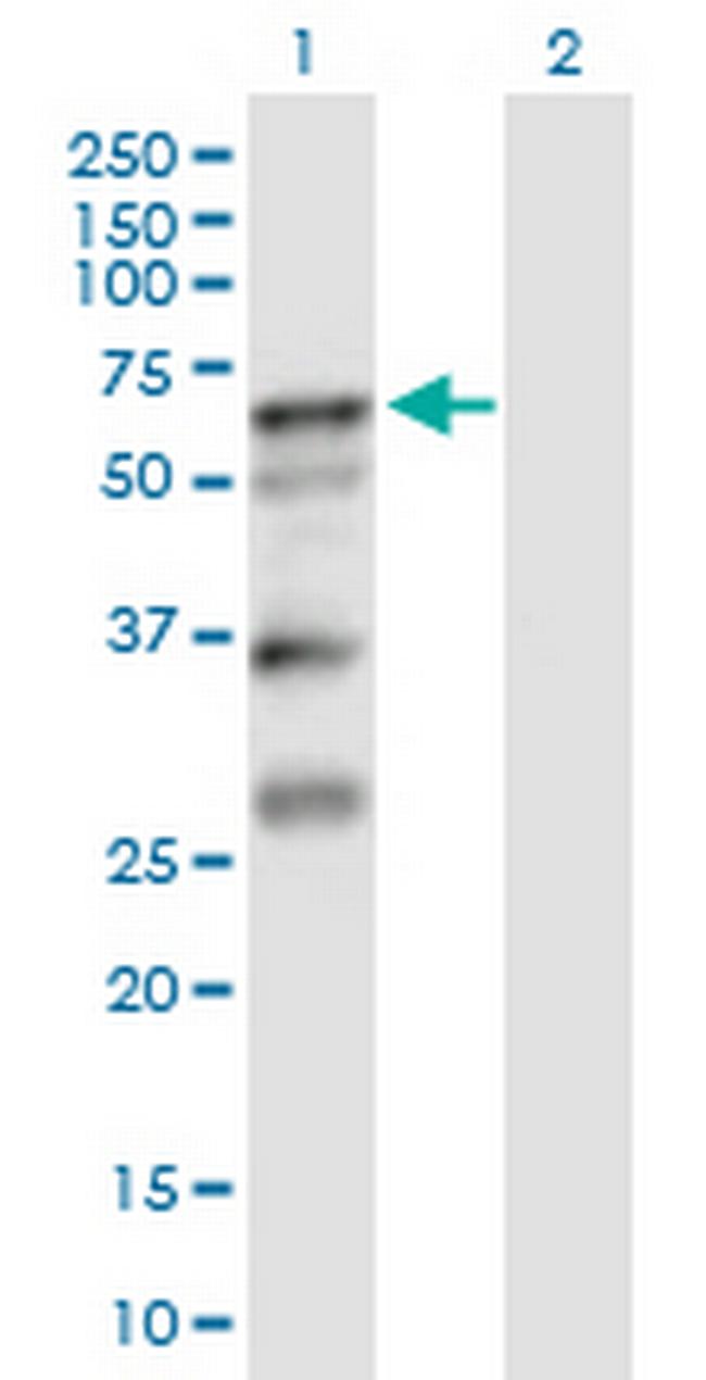 SERPINA10 Antibody in Western Blot (WB)