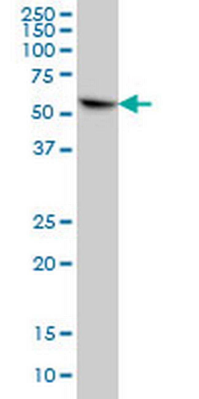 CYB5R4 Antibody in Western Blot (WB)