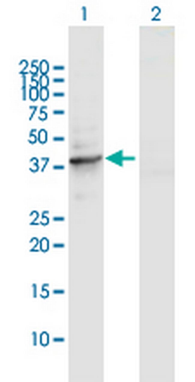TUBD1 Antibody in Western Blot (WB)