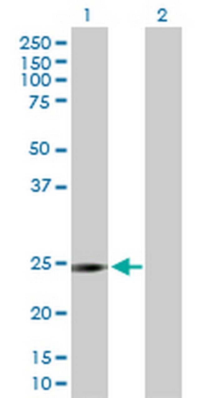DCXR Antibody in Western Blot (WB)