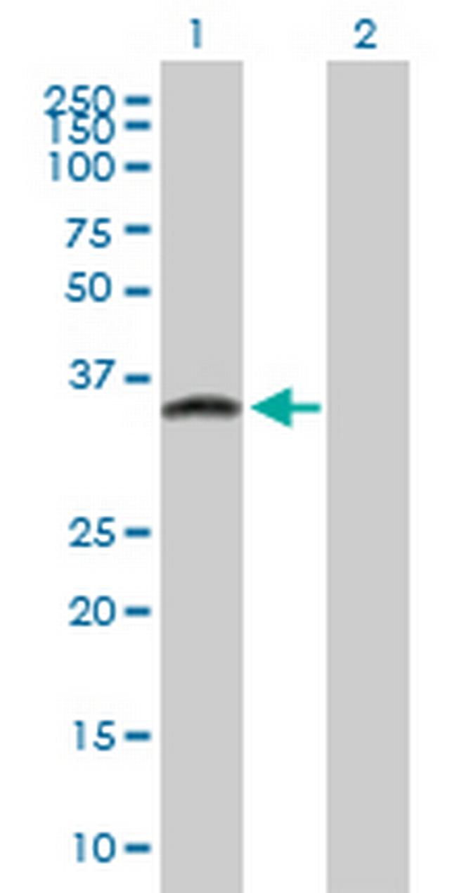 ATPBD1C Antibody in Western Blot (WB)