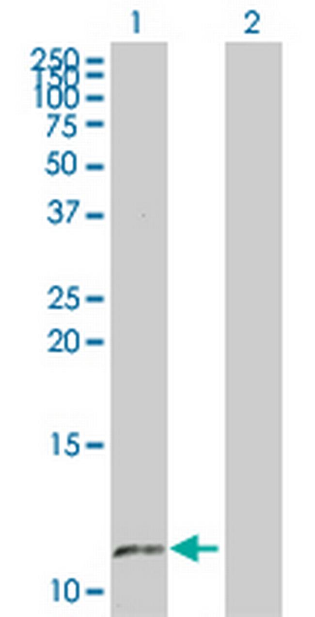 SS18L2 Antibody in Western Blot (WB)