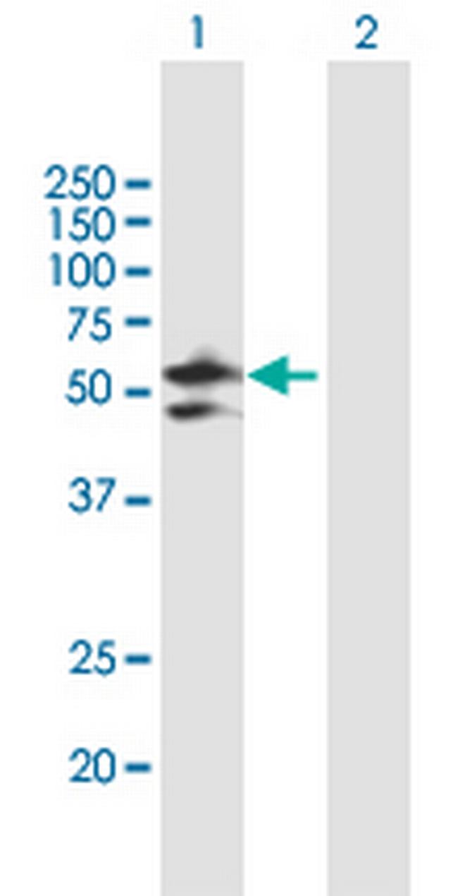 DDX47 Antibody in Western Blot (WB)