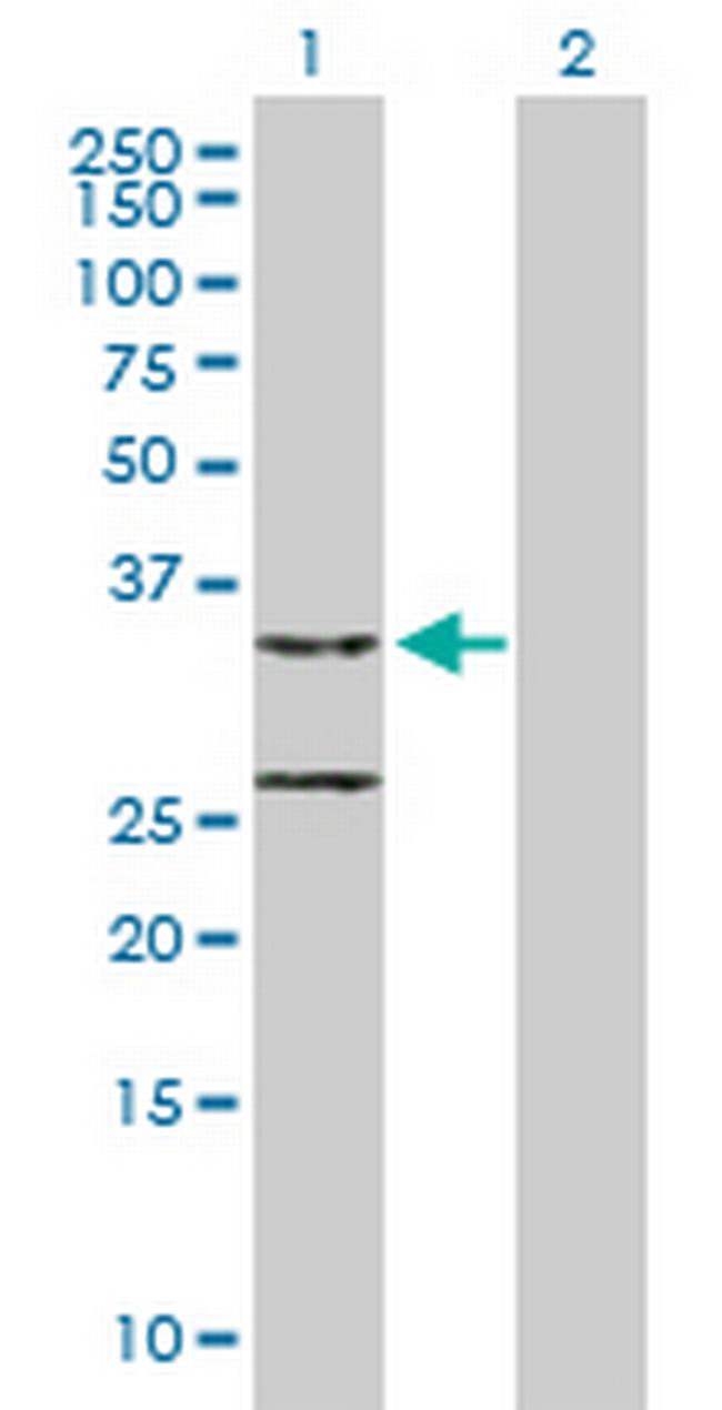 CCDC44 Antibody in Western Blot (WB)