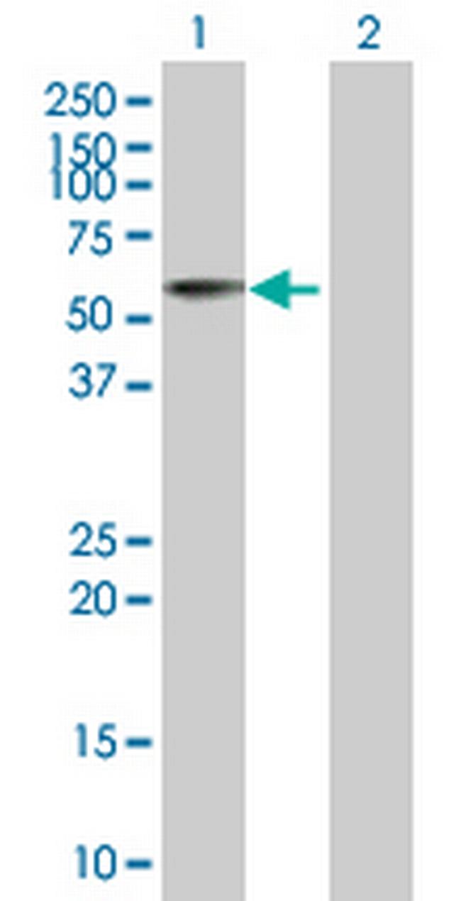 ACP6 Antibody in Western Blot (WB)