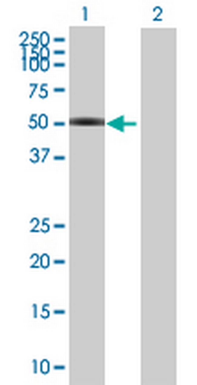 VRK3 Antibody in Western Blot (WB)