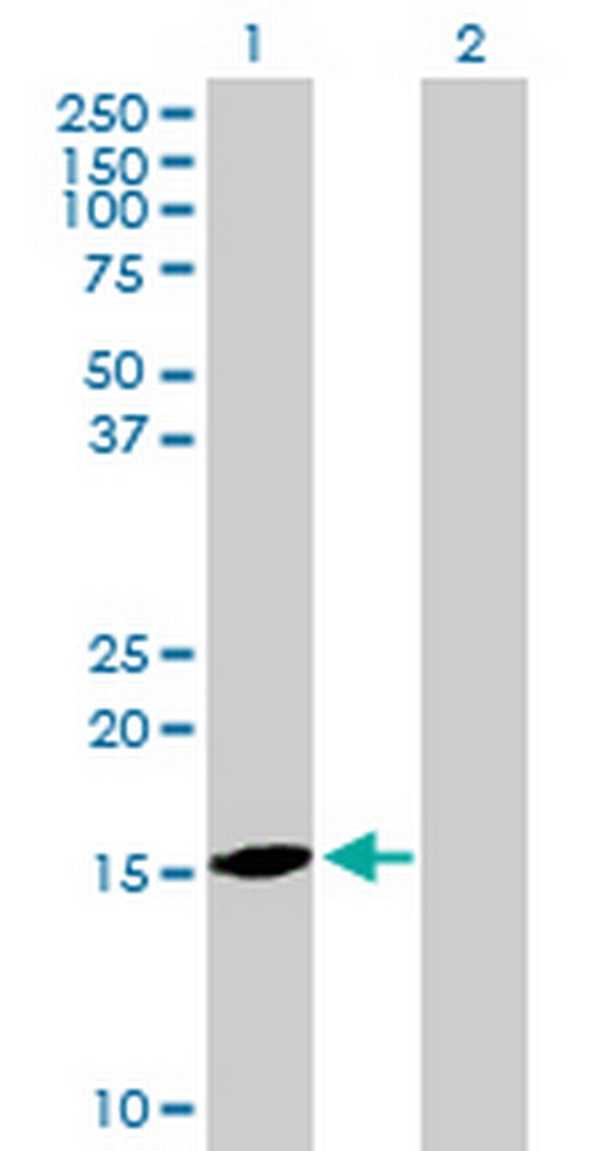 MGC29506 Antibody in Western Blot (WB)