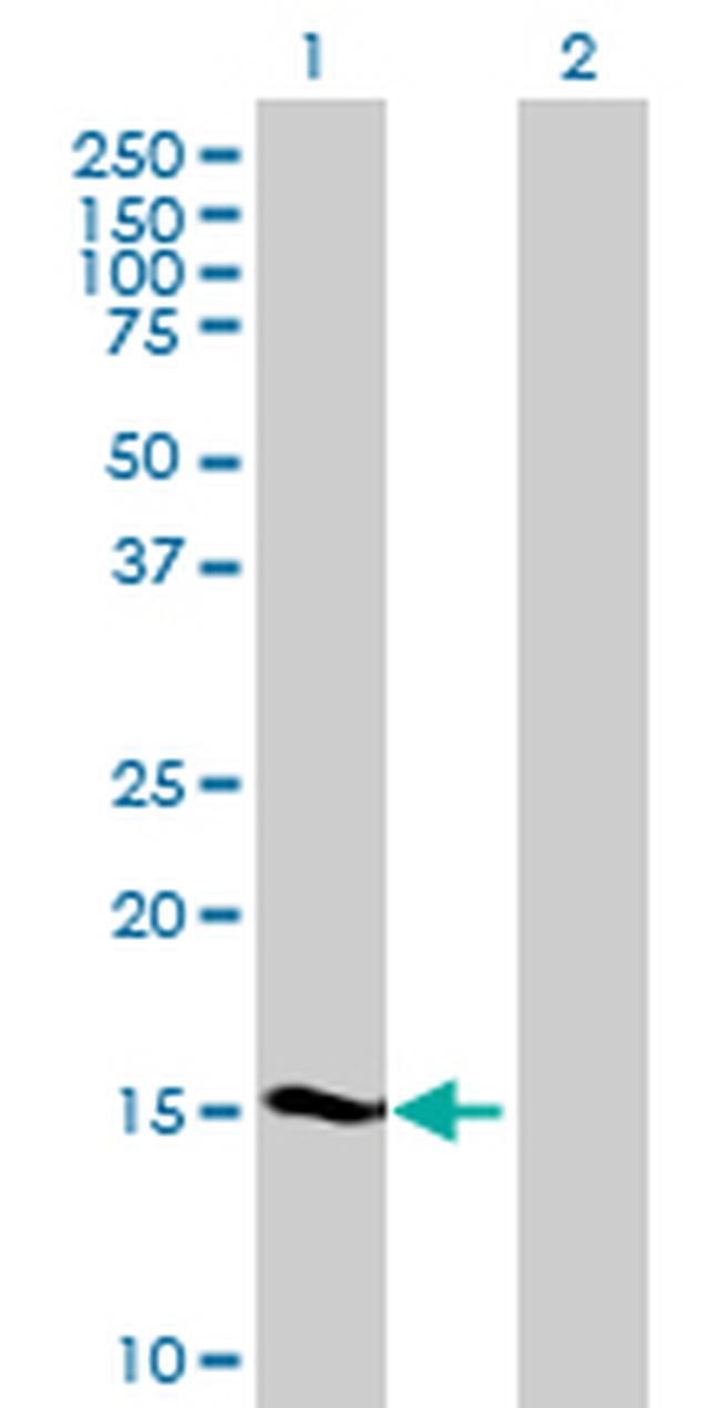 SHISA5 Antibody in Western Blot (WB)