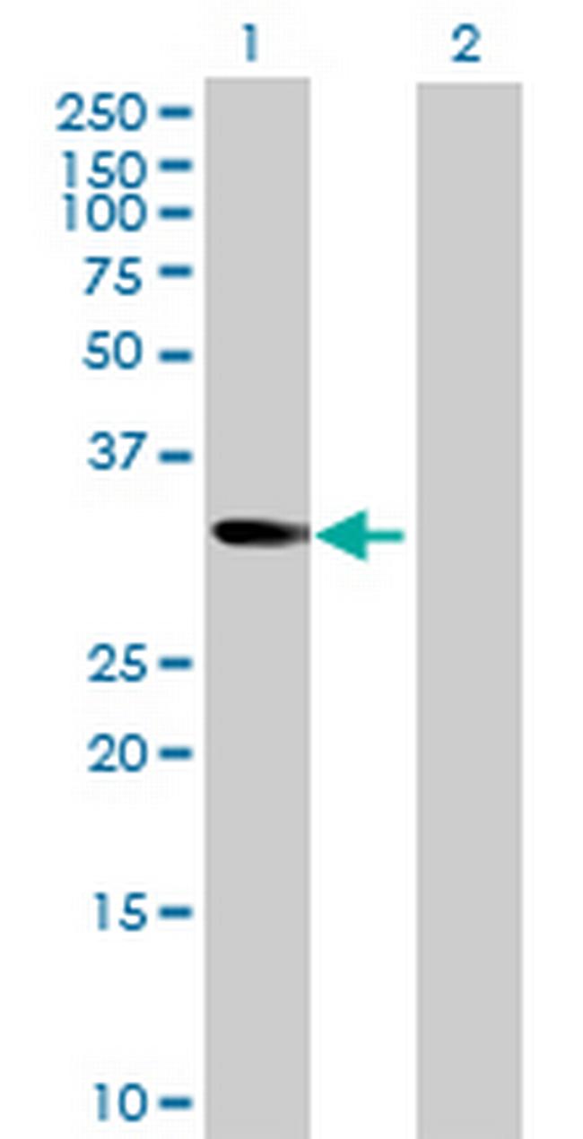 NT5C3 Antibody in Western Blot (WB)