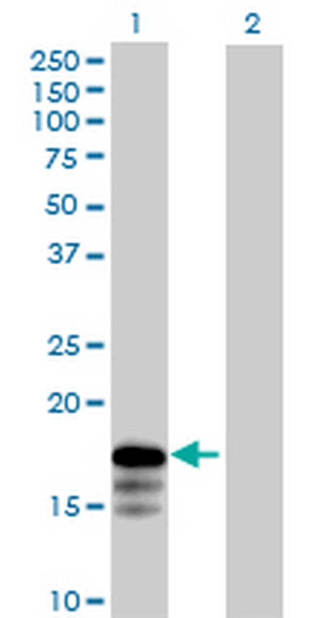 RNF181 Antibody in Western Blot (WB)