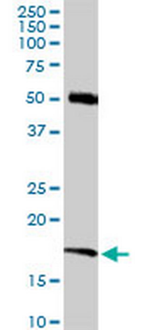 RNF181 Antibody in Western Blot (WB)