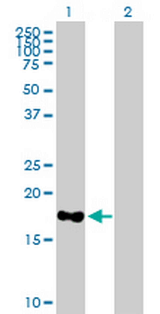 MARCH2 Antibody in Western Blot (WB)