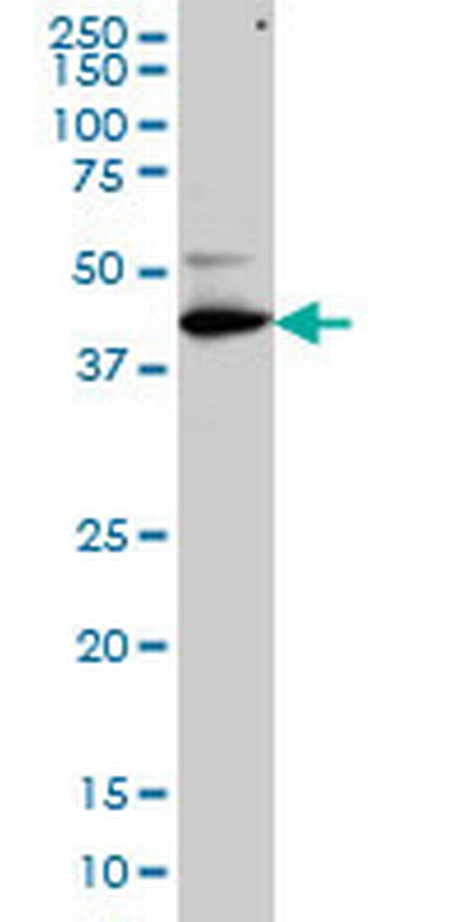 TFDP3 Antibody in Western Blot (WB)