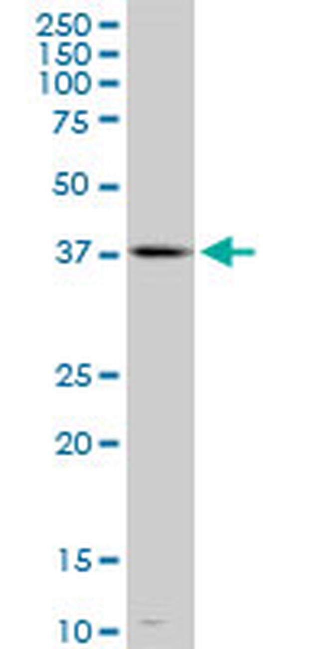 TFDP3 Antibody in Western Blot (WB)