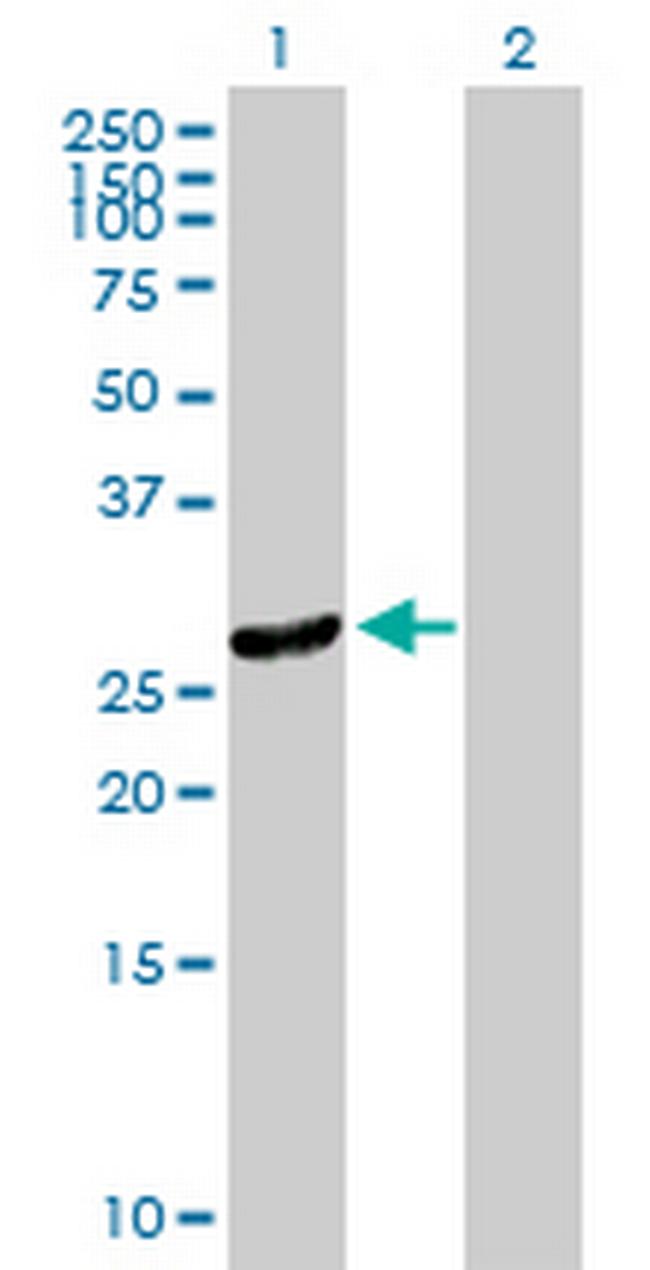 DNAJC27 Antibody in Western Blot (WB)