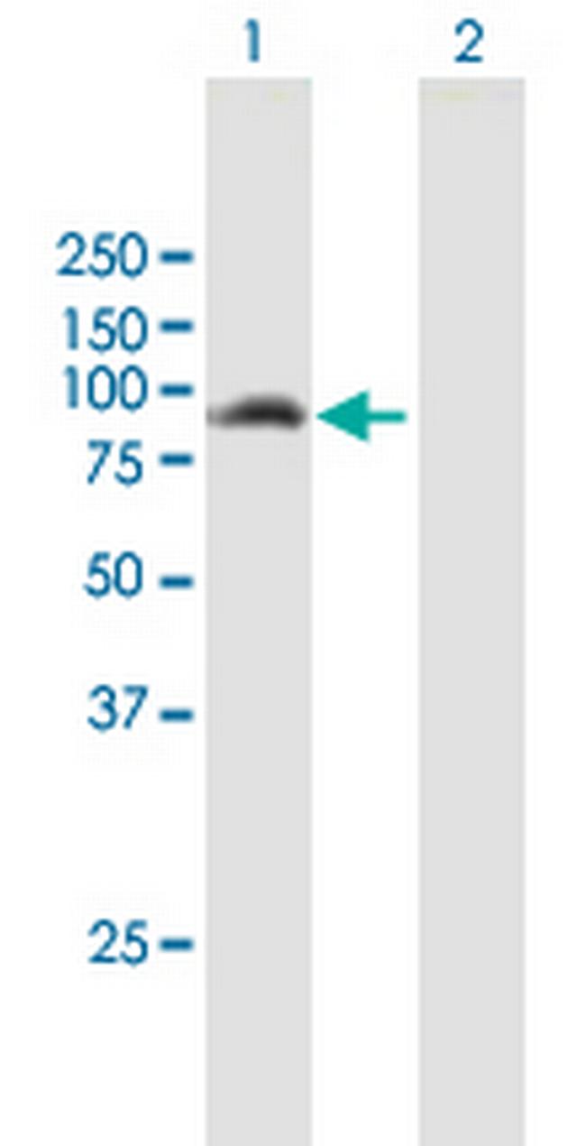 ANKMY1 Antibody in Western Blot (WB)