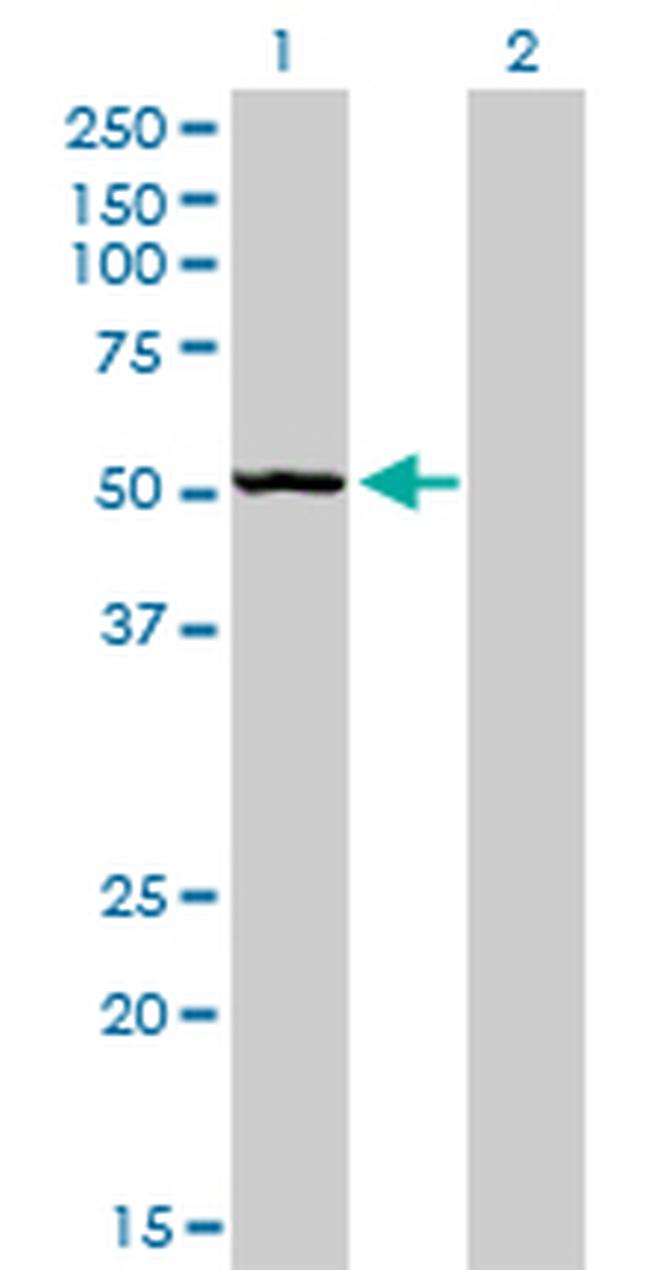 BFAR Antibody in Western Blot (WB)
