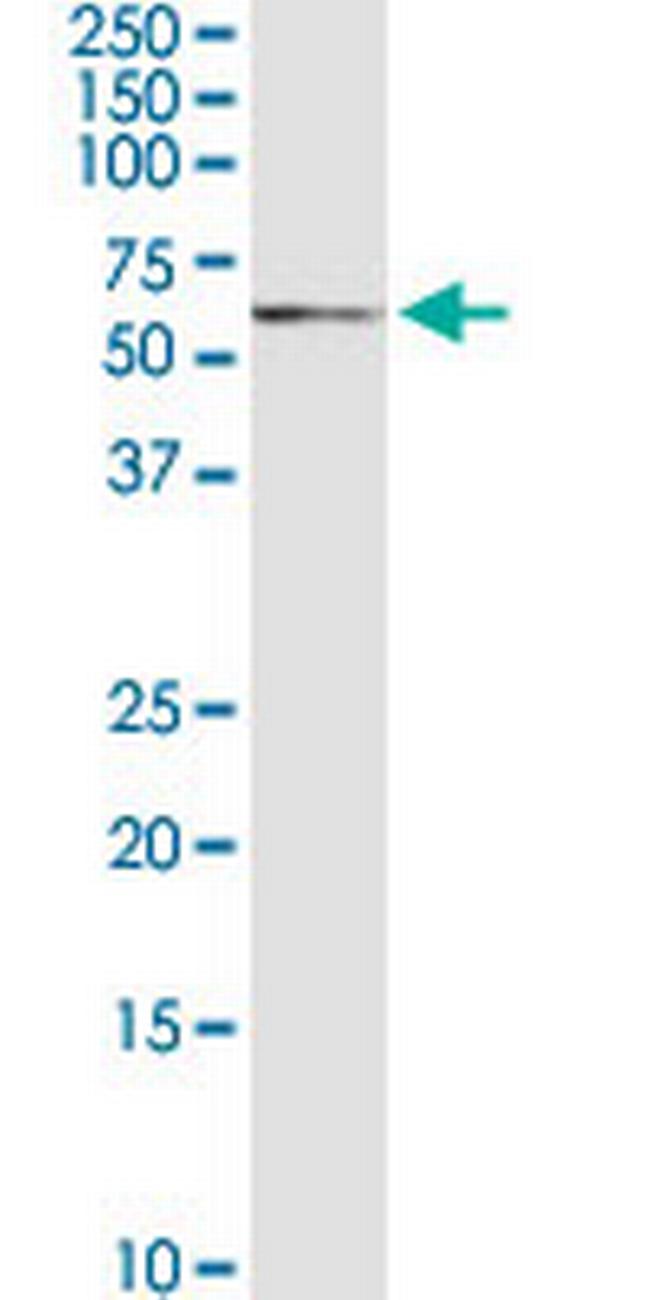 SLC15A3 Antibody in Western Blot (WB)
