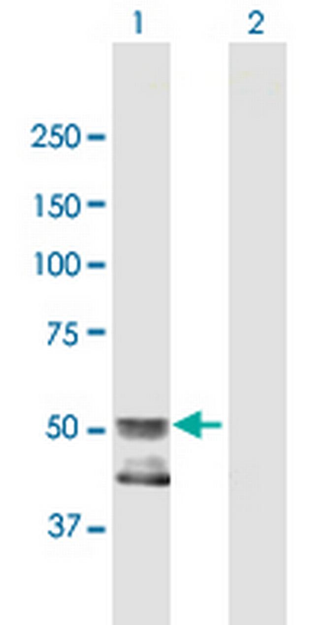 GCNT4 Antibody in Western Blot (WB)